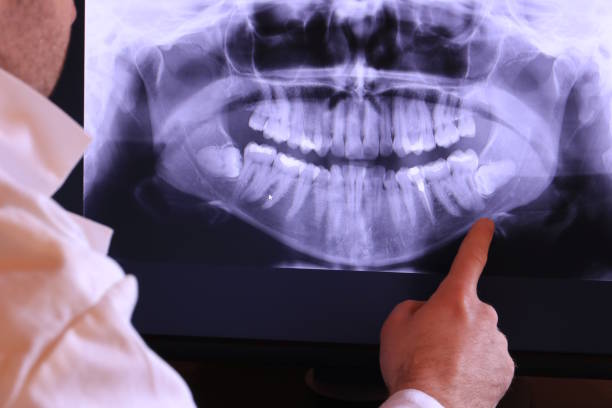 Best Walk-In Emergency Dental Services in Wellington, OH