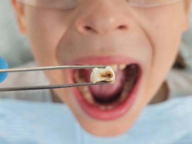Best Emergency Cosmetic Dentistry (e.g., broken veneers) in Wellington, OH